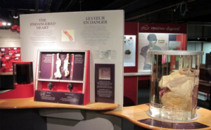 Ontario Science Centre - Human Body Exhibit